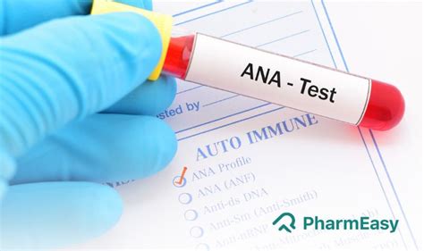 elisa test hindi|ana elisa test.